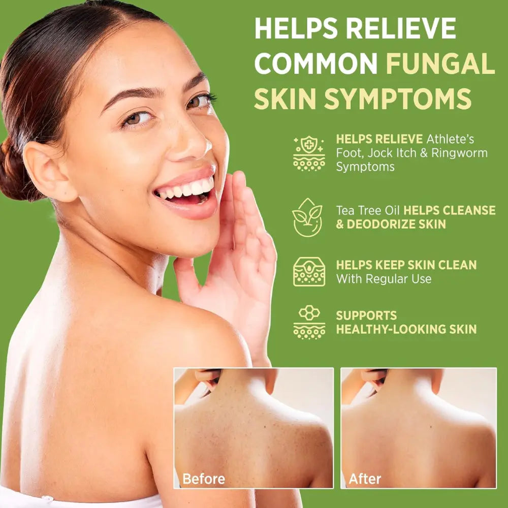 Zelyxov Antifungal & Allergy Soap™ - Zelyxov