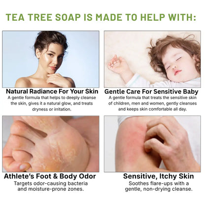 Zelyxov Antifungal & Allergy Soap™ - Zelyxov